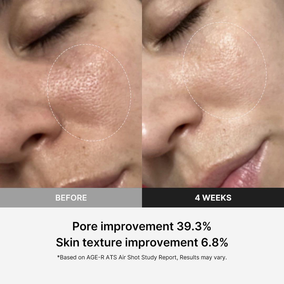 ATS Air Shot - medicube.us