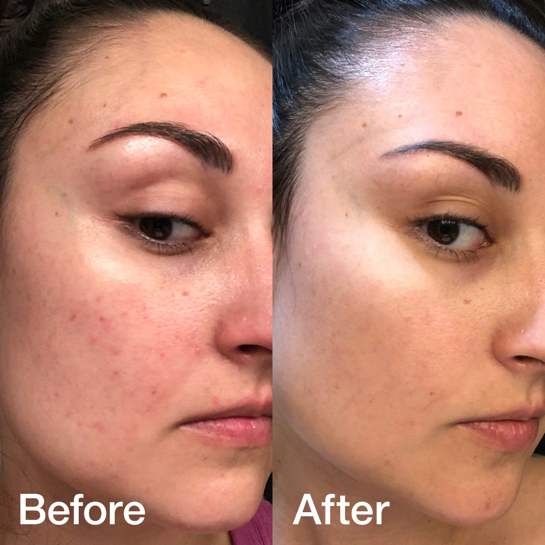 Glass Glow Duo 2.0 - MEDICUBE US