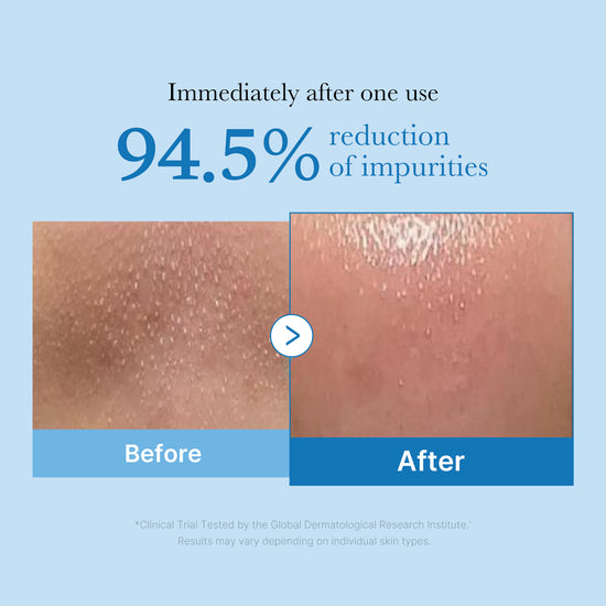 [BRTC] Anti Pollution & Blackhead Cleansing Oil main image 0