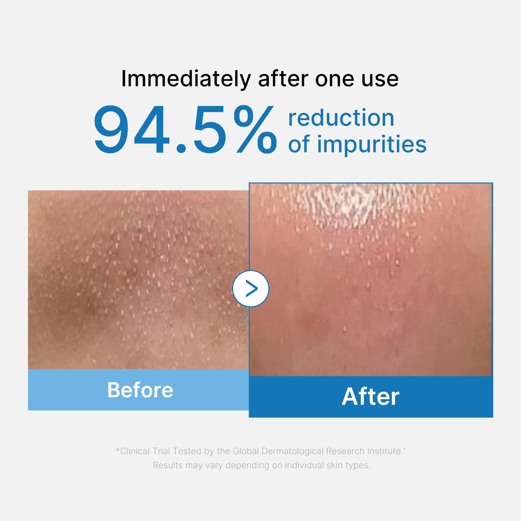 Zero Pore Blackhead Deep Cleansing Oil – MEDICUBE US