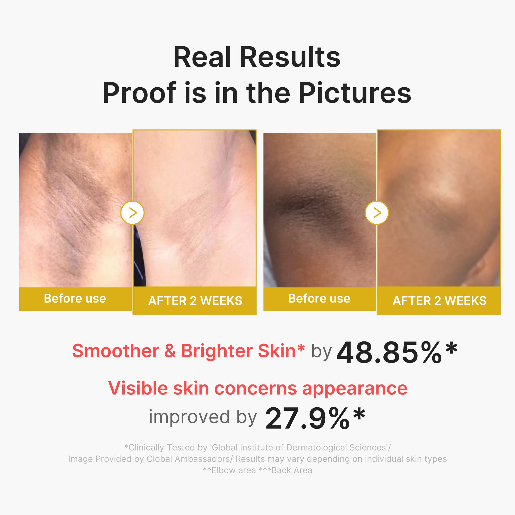 Kojic Acid Turmeric Body Peel Shot – MEDICUBE US