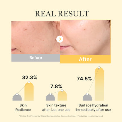 [Subscr.] Kojic Acid Turmeric Gold Jelly Gel Mask