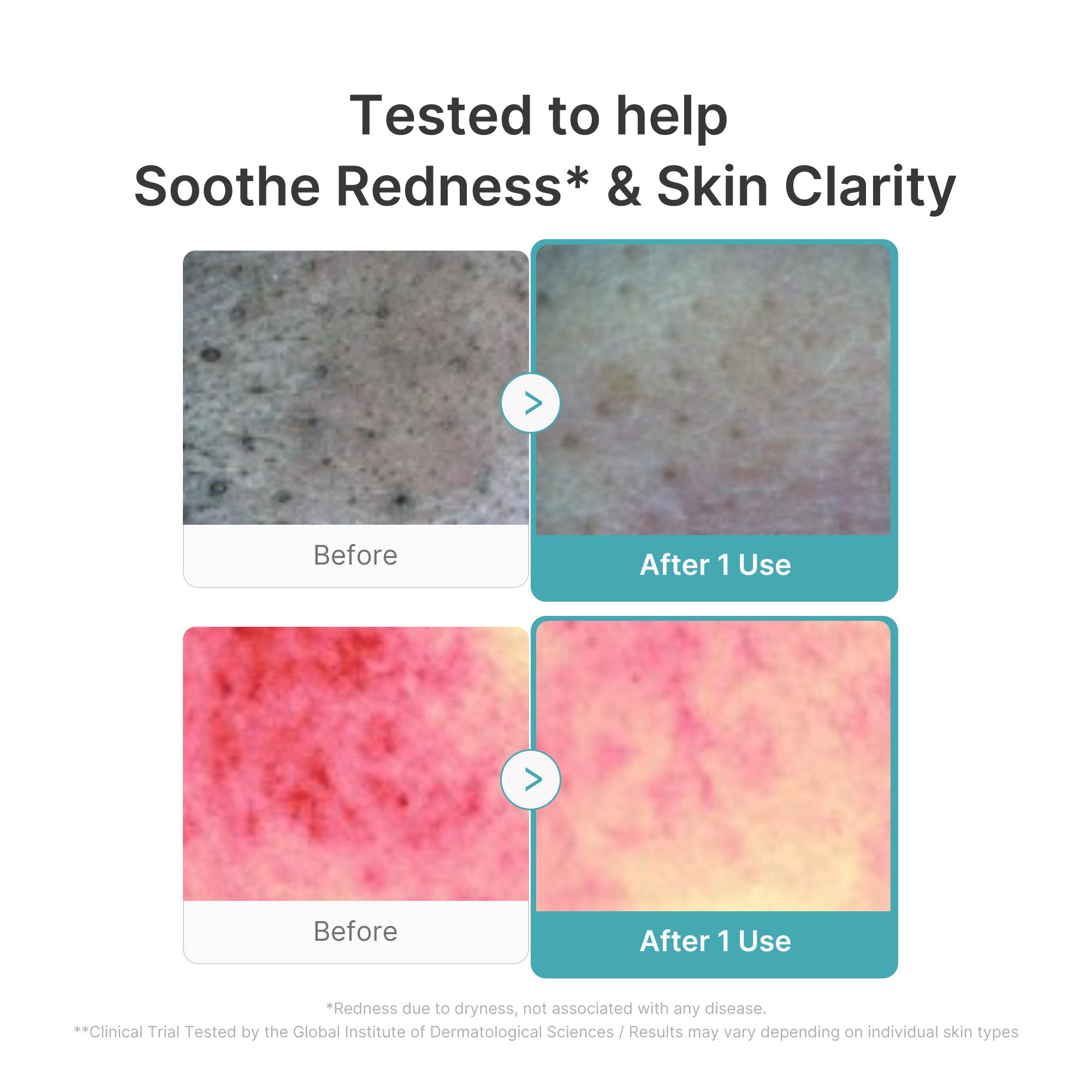 Azelaic Acid Capsule Foam Cleanser – MEDICUBE US