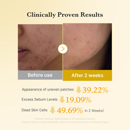 [Subscr.] Kojic Acid Tumeric Toner Pad