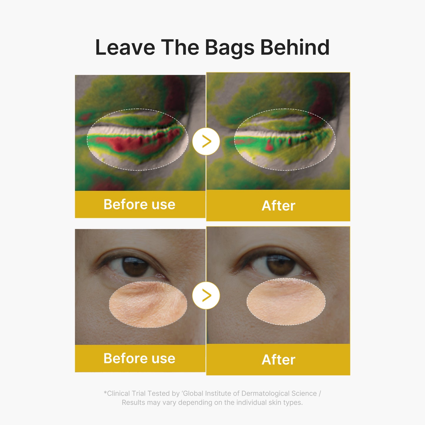 Kojic Acid Tumeric Eye Gel Serum - medicube.us