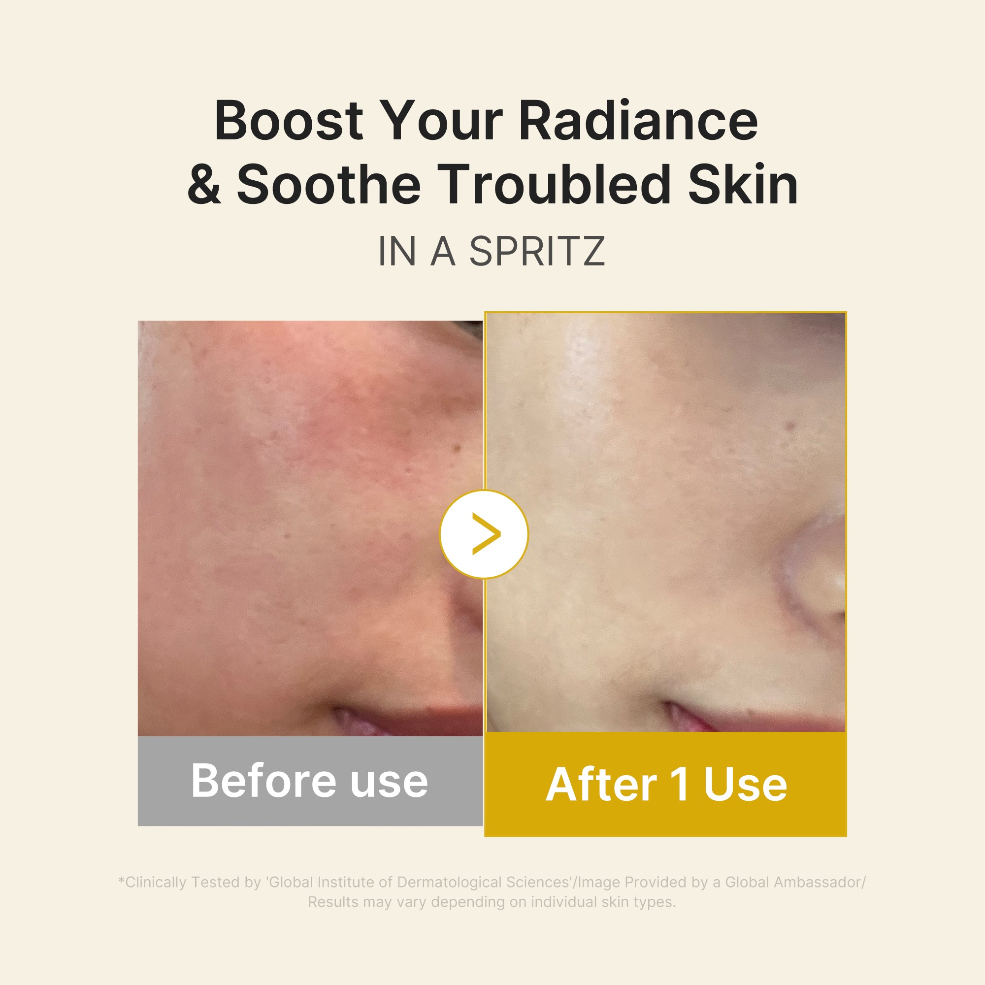 Kojic Acid Turmeric Vitamin Gold Jelly Mist Serum – MEDICUBE US