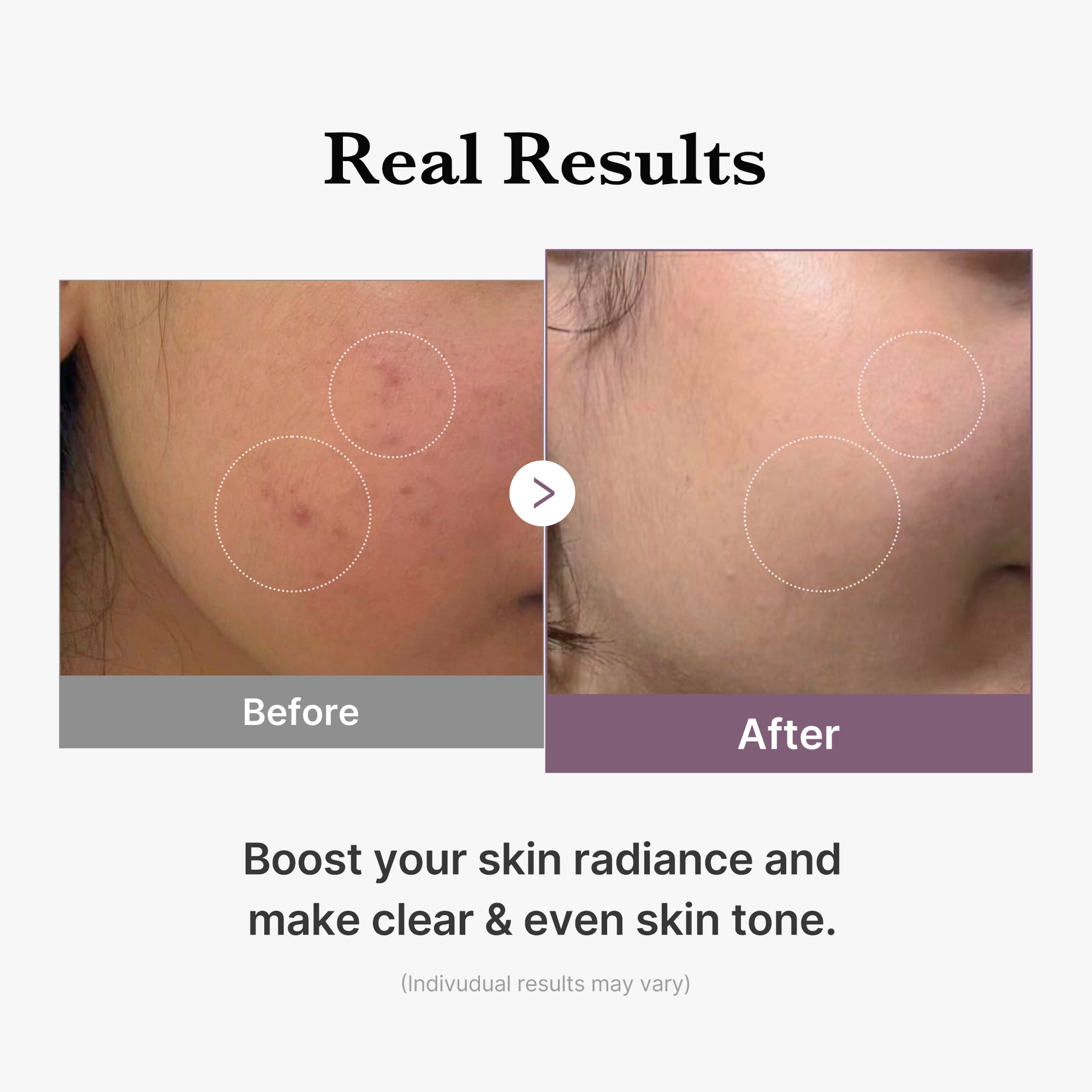 AGE-R Glutathione Glow Milk Toner AGE-R Glutathione Glow Milk Toner