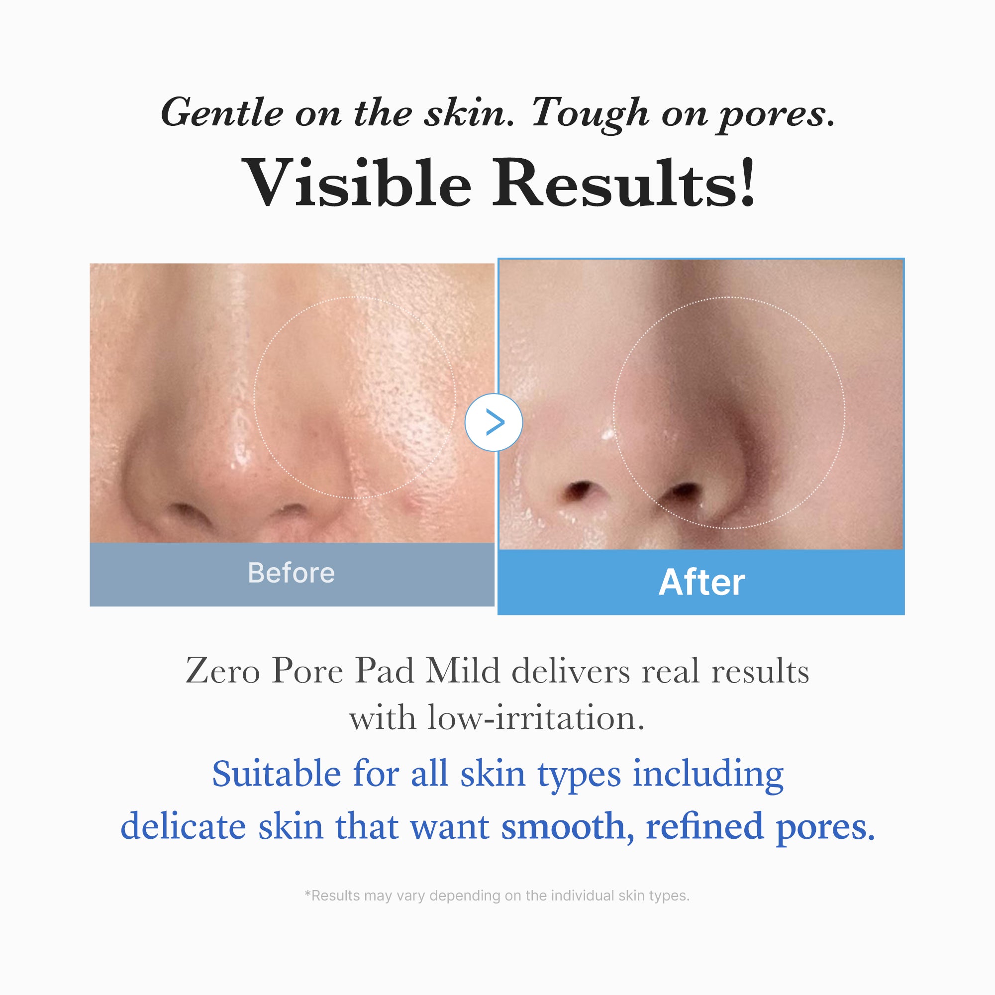 Zero Pore Madecassoside Pads (Mild) – MEDICUBE US