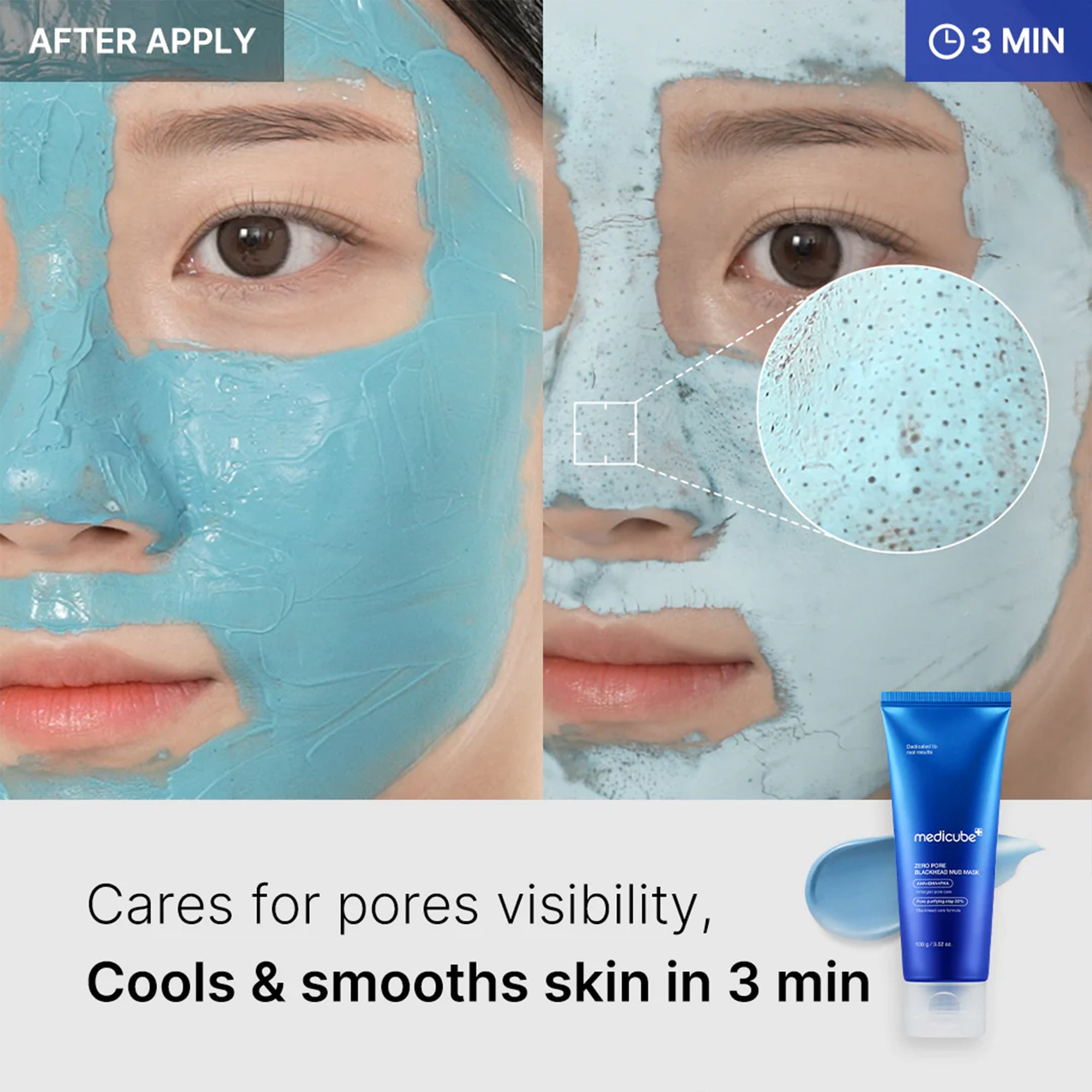 Zero Pore Blackhead Mud Mask – MEDICUBE US