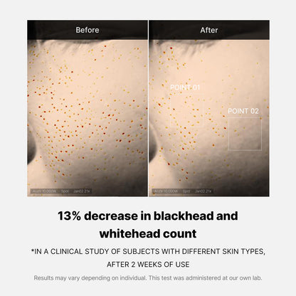 [Subscr.] Zero Pore One-day Serum