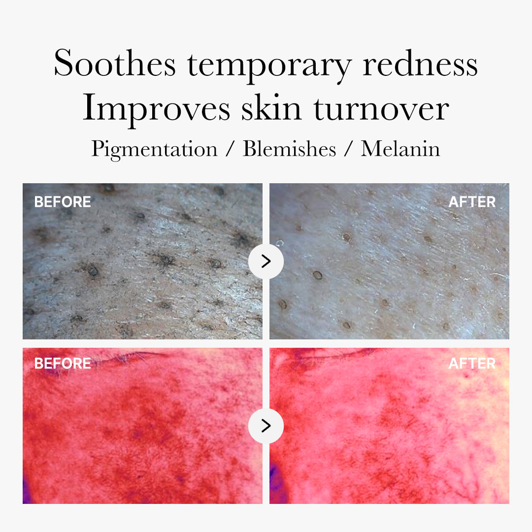 [Subscr.] Red Succinic Acid Panthenol Pads