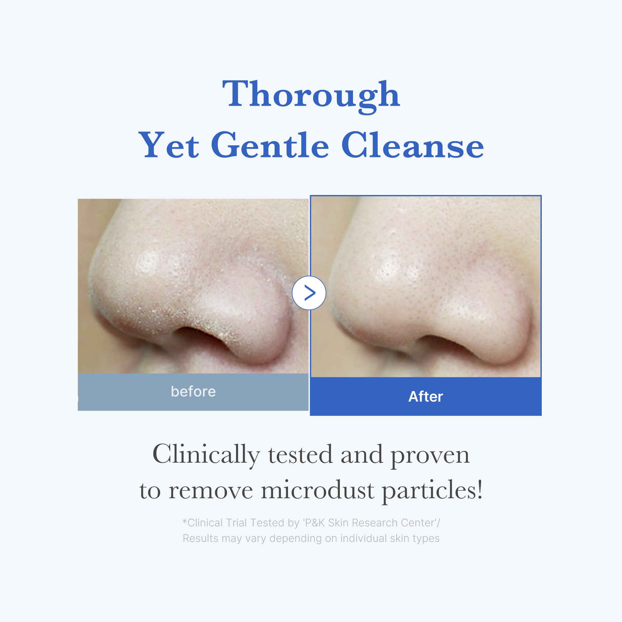 Subscr.] Zero Foam Cleanser – MEDICUBE US