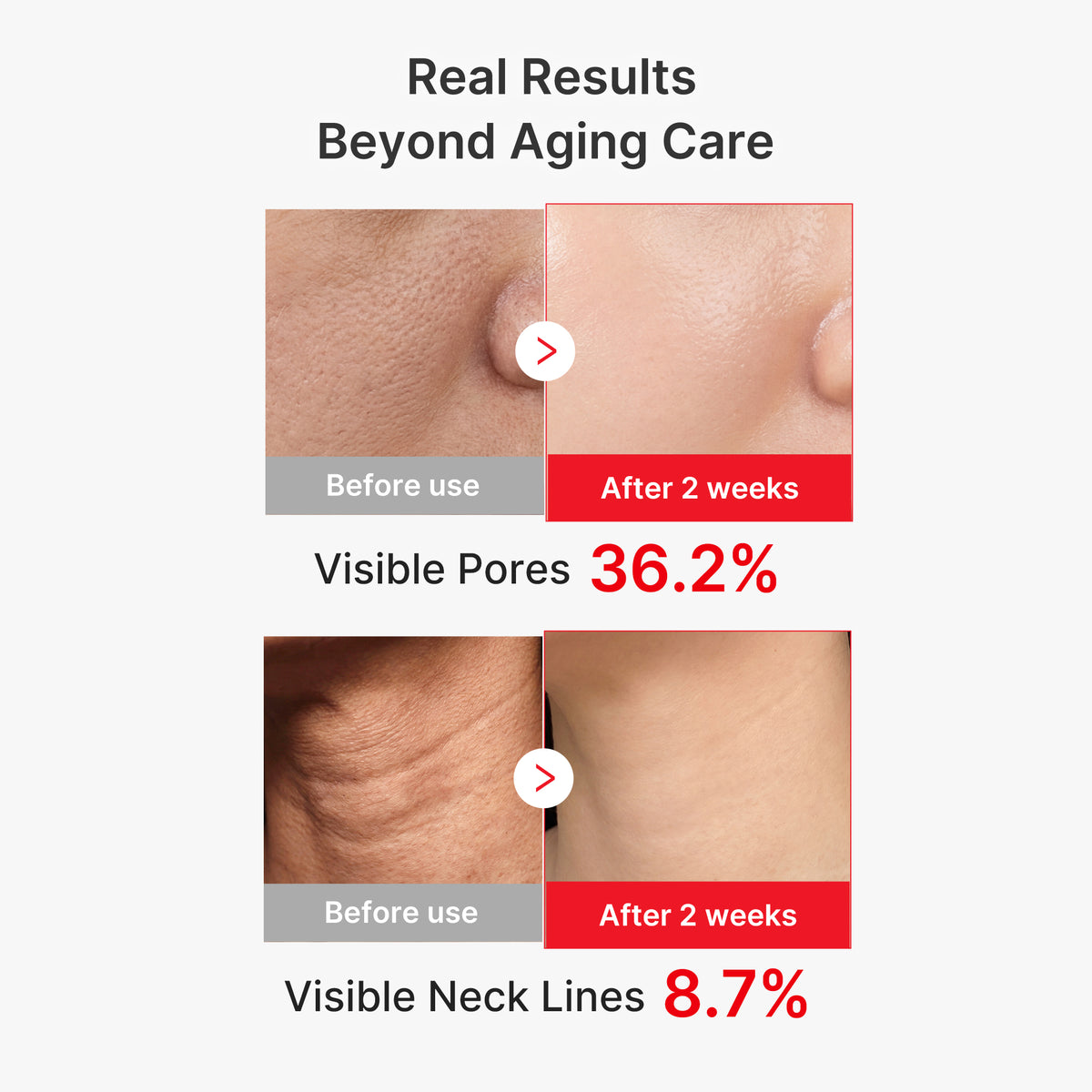[Exclusive Deal] Amazon’s #1 Beauty Brand |  EGF NAD+ Firming Serum
