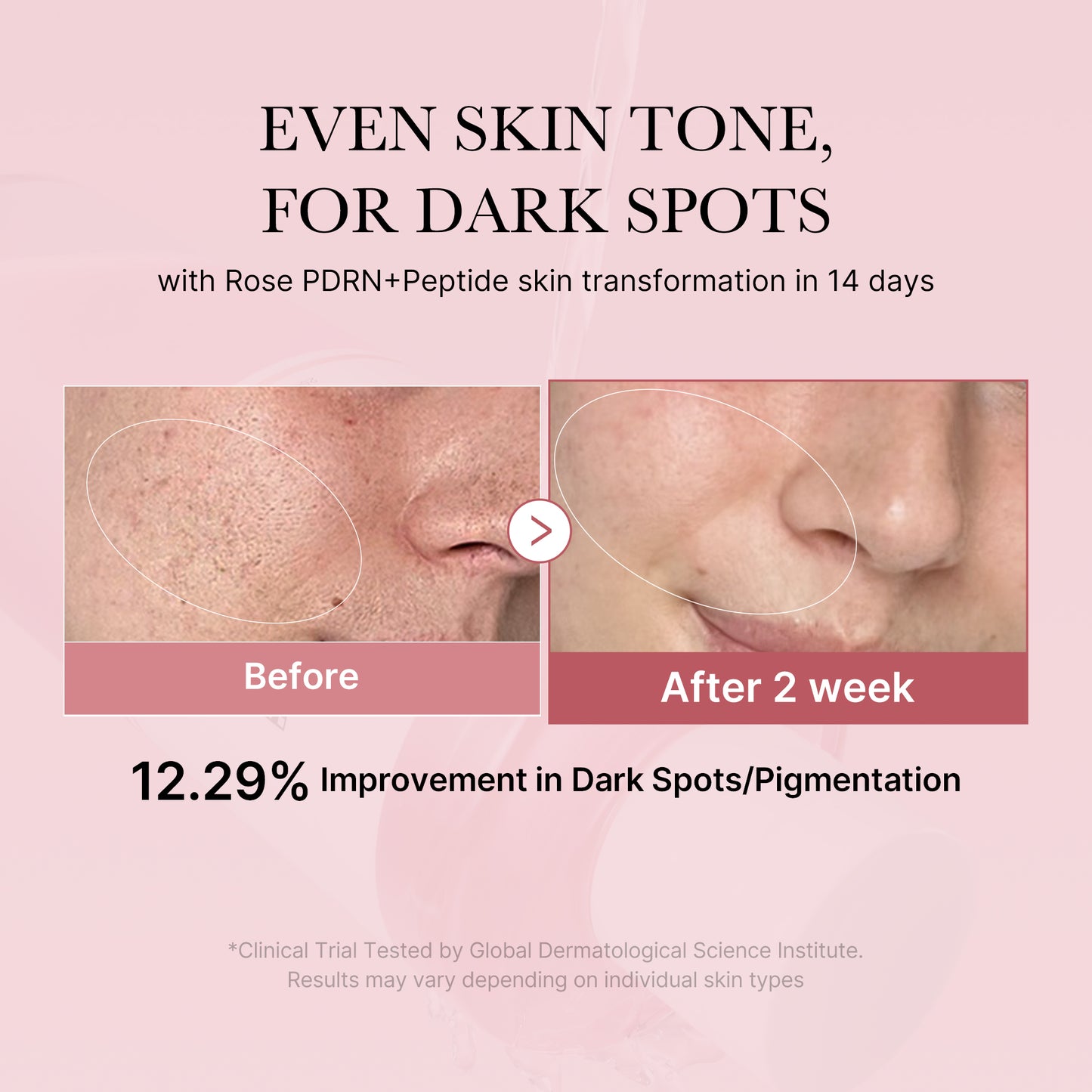 PDRN Pink Peptide Toner