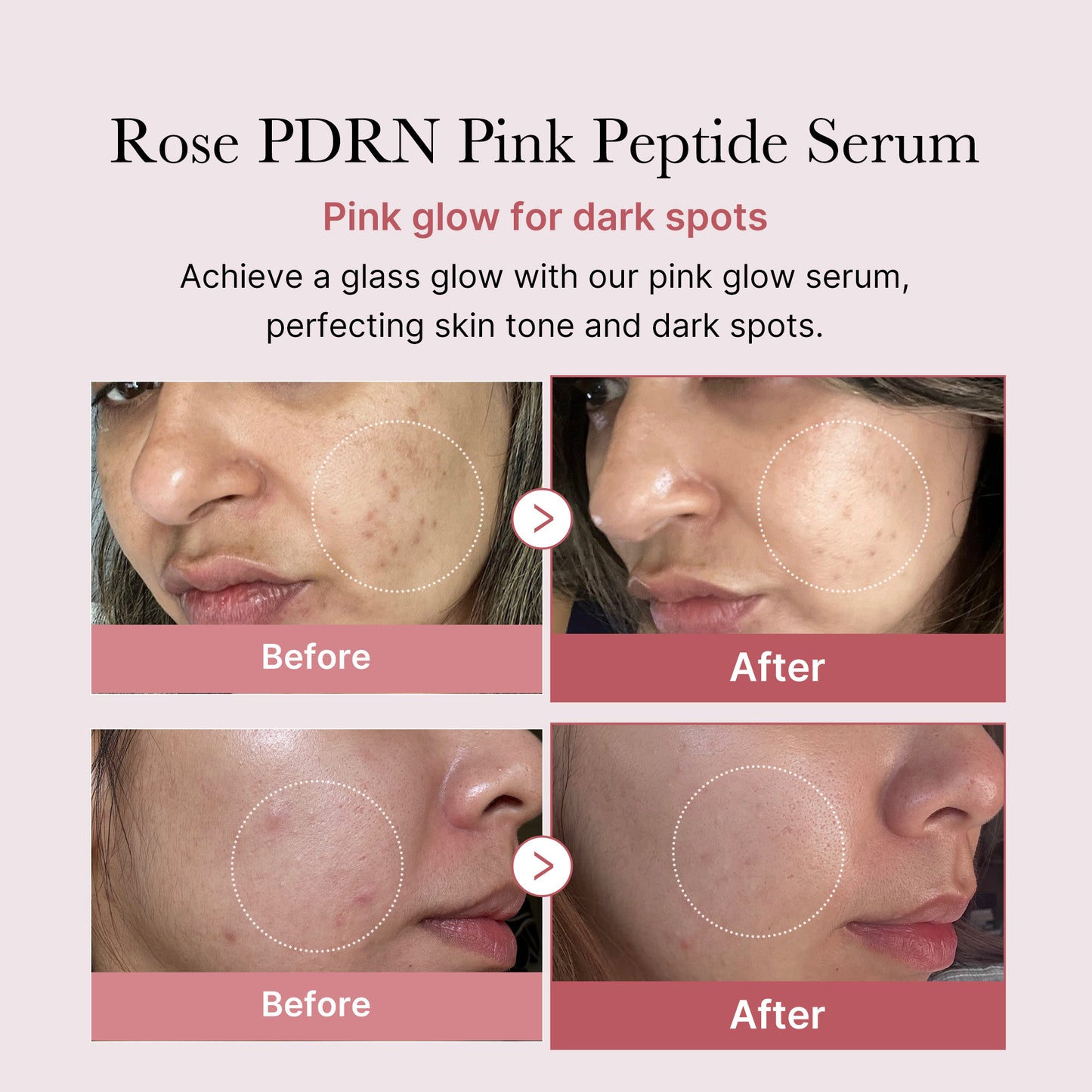 Rose PDRN Pink Peptide Serum