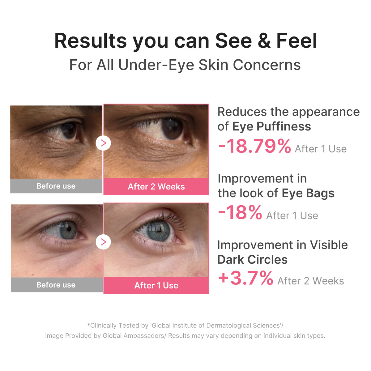 [Exclusive Deal] Amazon’s #1 Beauty Brand |  PDRN Caffeine Collagen Eye Patch