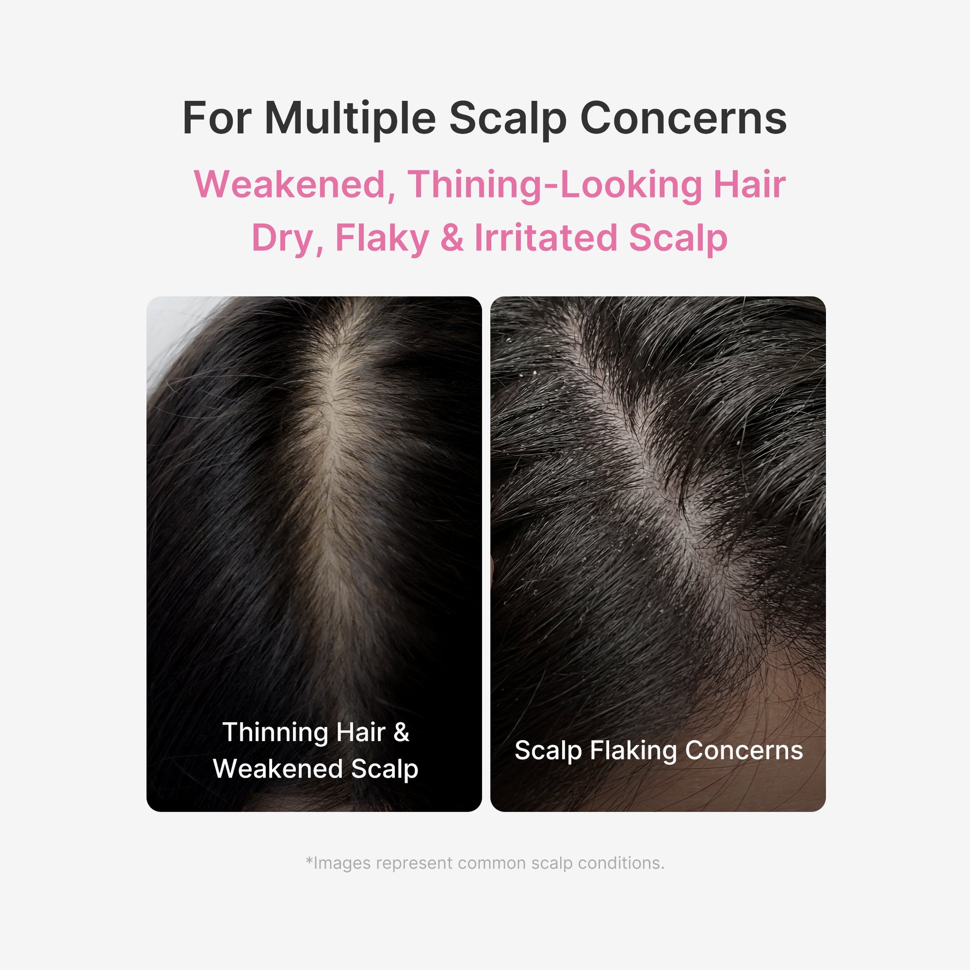 Rosemary PDRN Scalp Serum - medicube.us