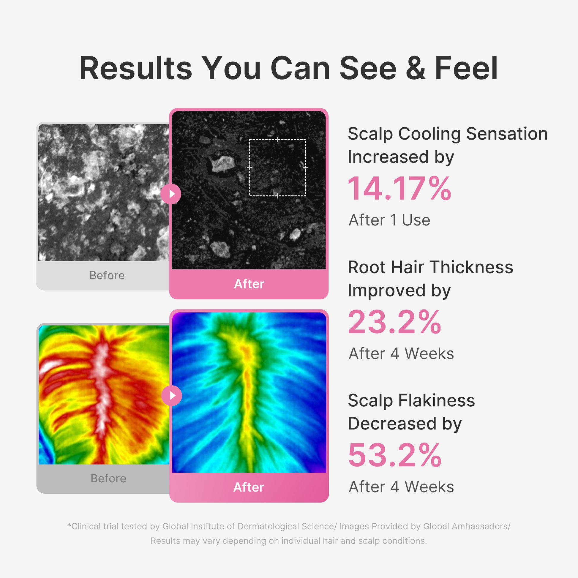 Rosemary PDRN Scalp Serum - medicube.us