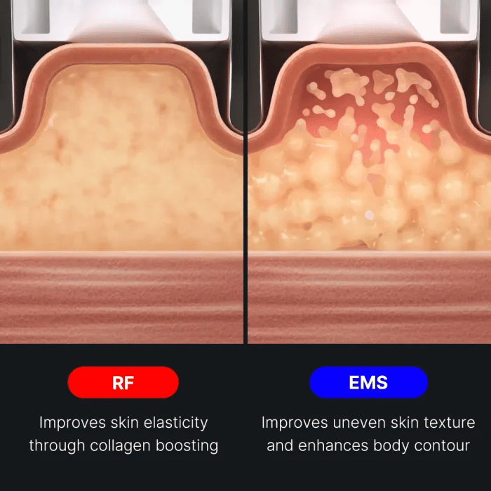 AGE-R Contour Body Shot – MEDICUBE US AGE-R Contour Body Shot – MEDICUBE US