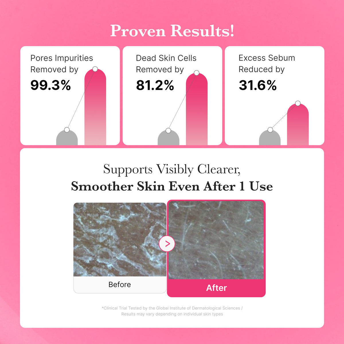 [Exclusive Deal] Amazon’s #1 Beauty Brand | PDRN Pink Gel Cleanser