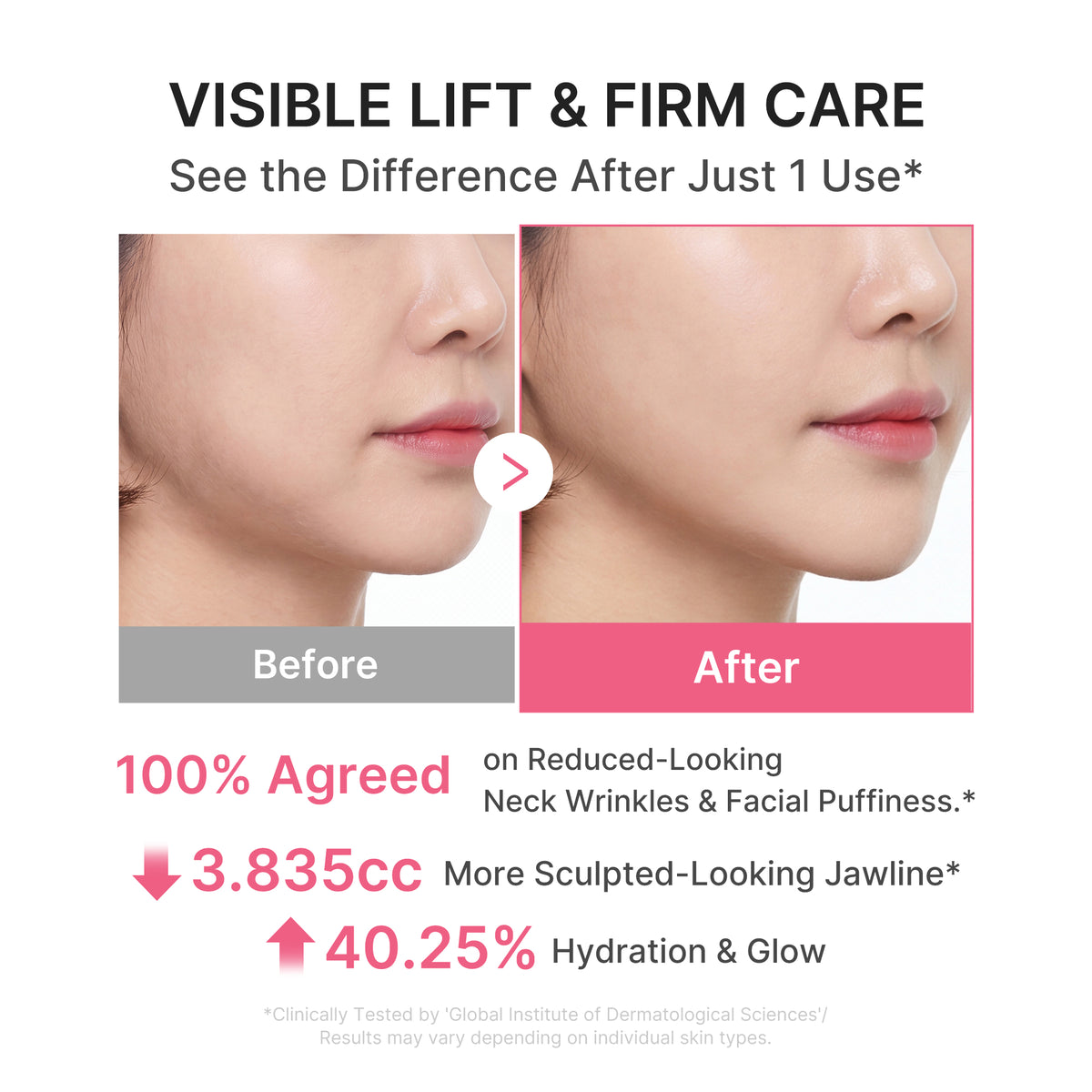 [Exclusive Deal] Amazon’s #1 Beauty Brand |  PDRN Collagen Gua Sha Neck Wrinkle Cream